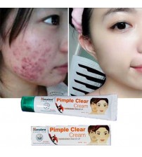 Himalaya Herbals Acne n Pimple Clear Cream 20g